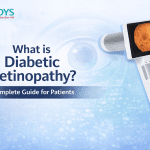 What is Diabetic Retinopathy Complete Guide for Patients